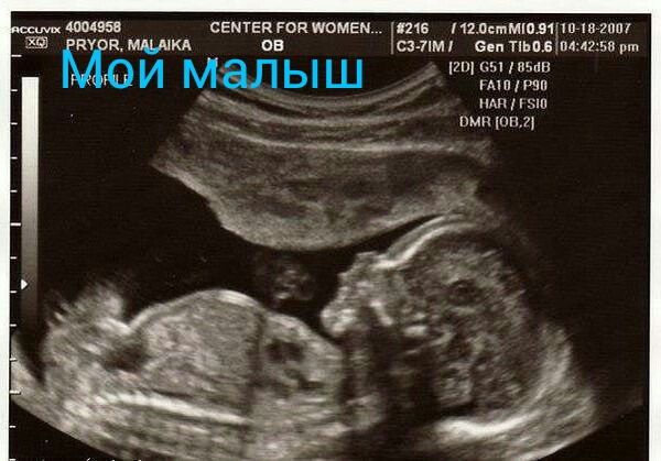 Жанка Рахман