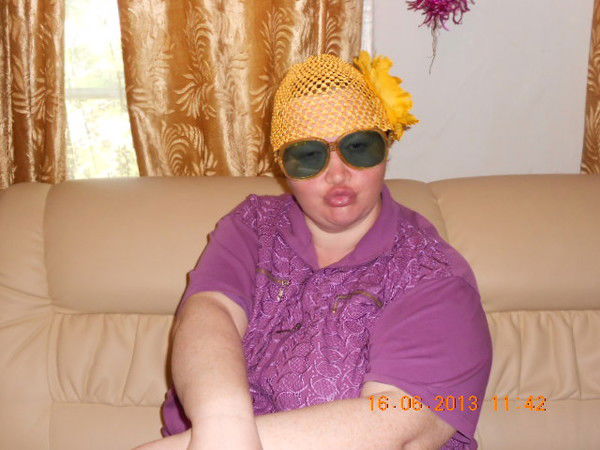 Маргаритка Клондайк