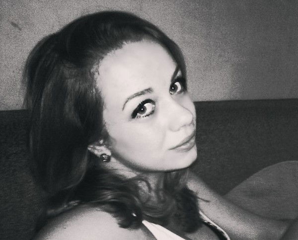 Лера Витковская