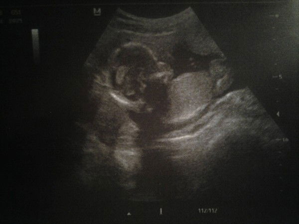 Erbolat_Aselya Esenalievi