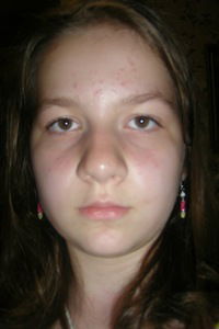 Алиса Абдурагимова