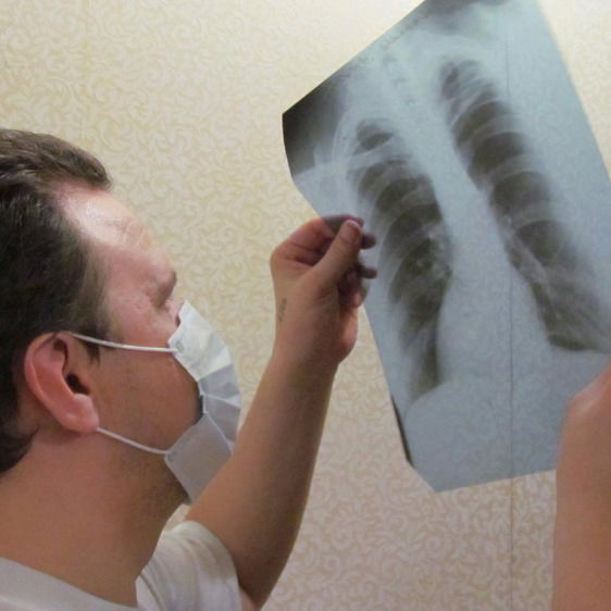 Детский Туб. Жанакорган