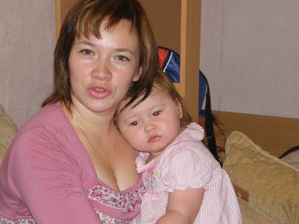 Альбина Федотова