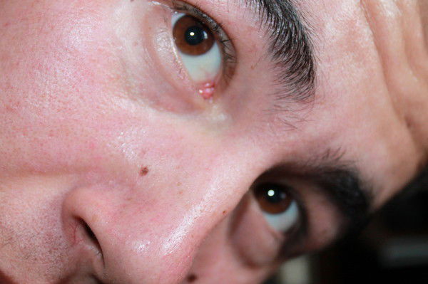 Ибрагим Белый