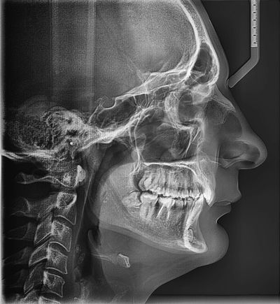 Дмитрий Атакоткин