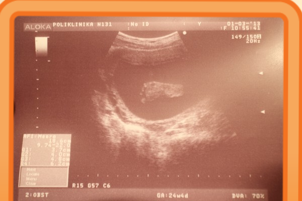 Евгений Артеменко