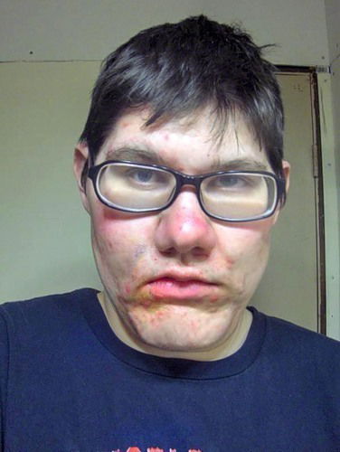 Квитэссенция Маразма