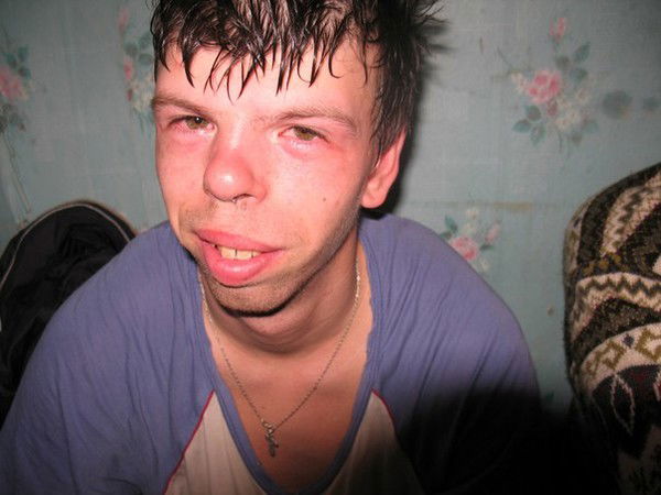 Антон Савейко