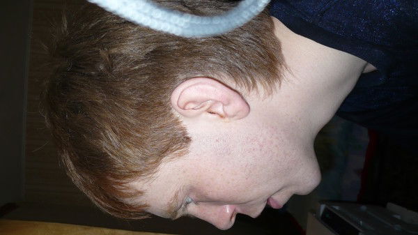 Александр Герцевич