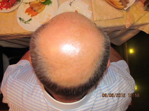 Олег Лебедев