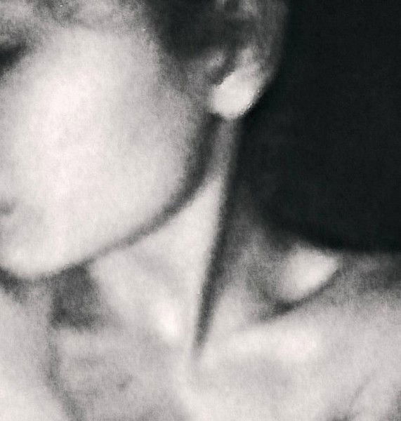 ▲Боюсь Эболу▼