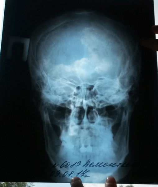 Андрей Дементьев