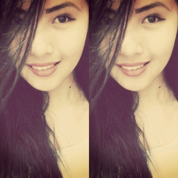 Албанка Жакось