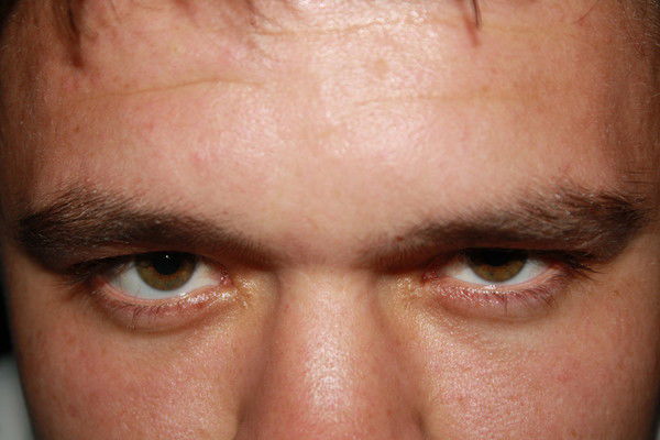 Александр Федотов