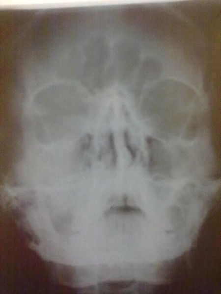 Александр Федюшкин