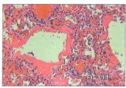 Зульфия Закирова