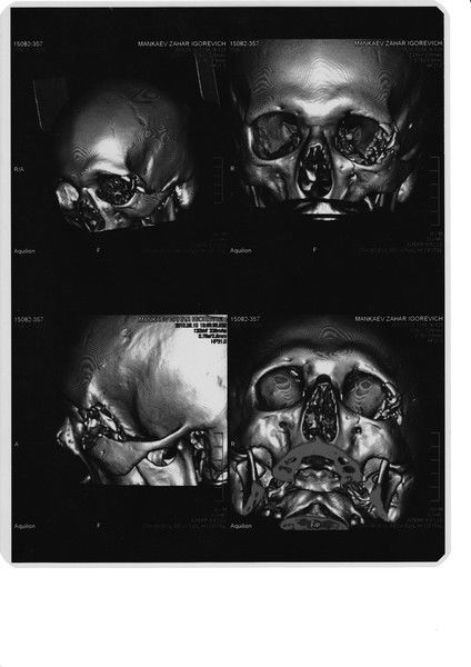 Узюзюк Толстый