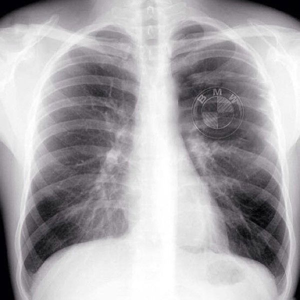 Алихан Бейсенов