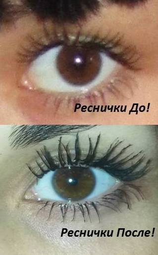 Генетик Тест Звоните