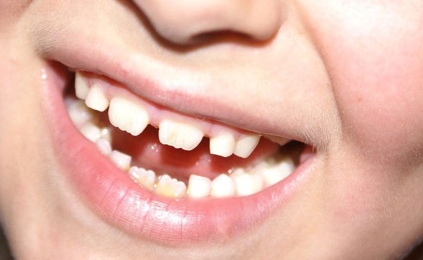 Григорий Ляшенко